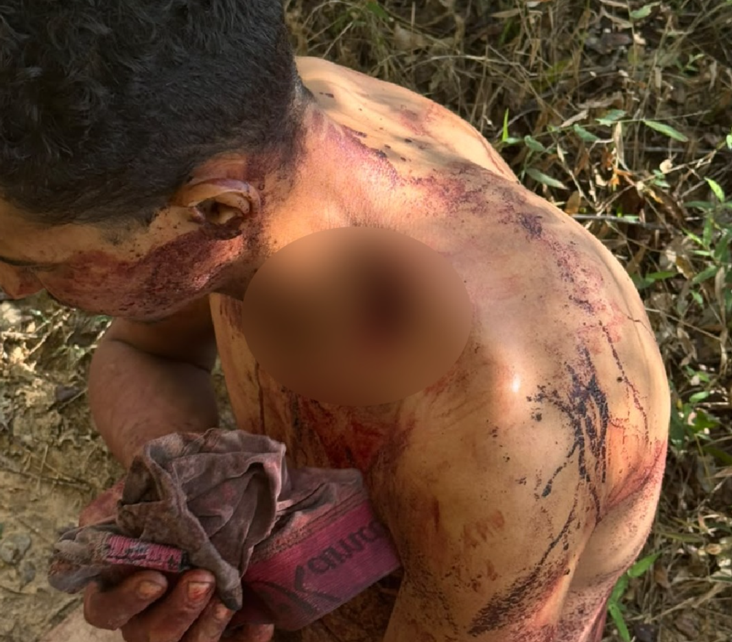 Nu e gravemente ferido, homem é resgatado pela Polícia Militar