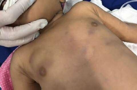 Pais negam agress&otilde;es e relatam uso constante de maconha antes de beb&ecirc; morrer