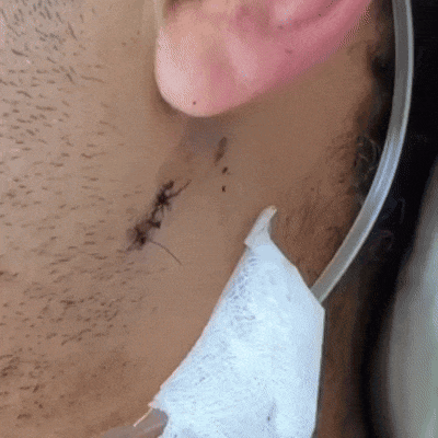 &ldquo;Pedi para cuidar do meu filho&rdquo;, diz sargento baleado durante confronto 
