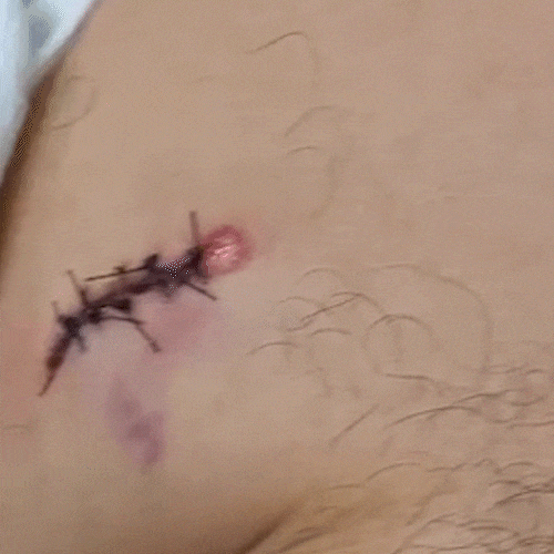 &ldquo;Pedi para cuidar do meu filho&rdquo;, diz sargento baleado durante confronto 