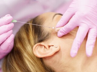 Mulher ganha indenização após ter rosto deformado por fios de rejuvenescimento Mulher ganha indenização após ter rosto deformado por fios de rejuvenescimento