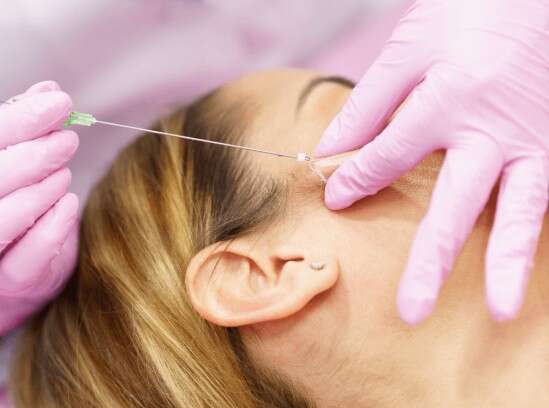 Mulher ganha indeniza&ccedil;&atilde;o ap&oacute;s ter rosto deformado por fios de rejuvenescimento