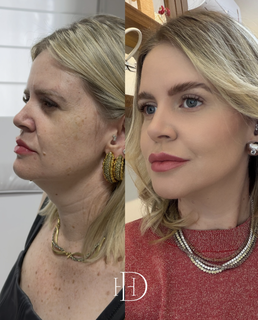 Est&eacute;tica regenerativa: o novo luxo vai al&eacute;m dos preenchedores