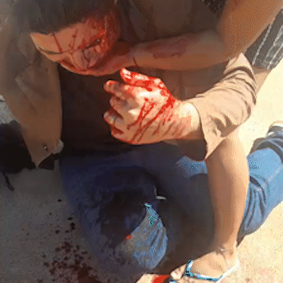 Jornalista aparece ensanguentado e diz que foi agredido por persegui&ccedil;&atilde;o pol&iacute;tica