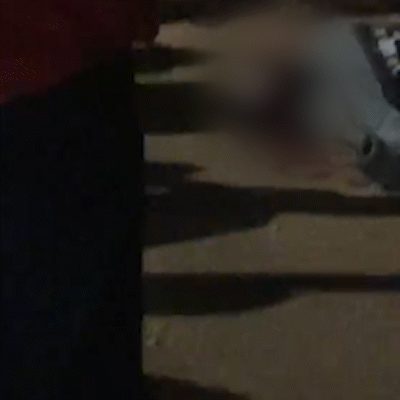 Baleado no Noroeste tem tr&ecirc;s perfura&ccedil;&otilde;es na cabe&ccedil;a e sinais de morte cerebral