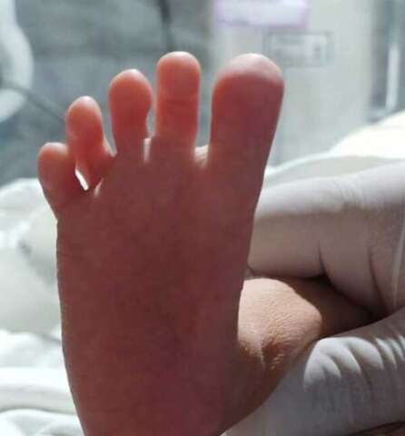 Sete pessoas se oferecem para acolher beb&ecirc; com quadro grave de sa&uacute;de