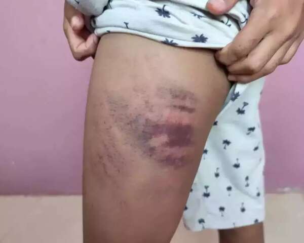 Mãe agride menino de 12 anos e culpa família de colega