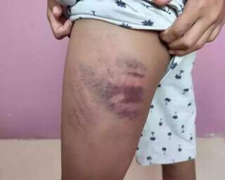 Investigação conclui que mãe agrediu filho autista e culpado colega de escola