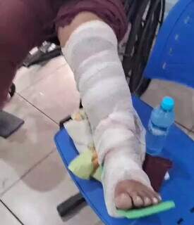 "Estavam caçando vítima", diz mulher derrubada de moto durante assalto "Estavam caçando vítima", diz mulher derrubada de moto durante assalto