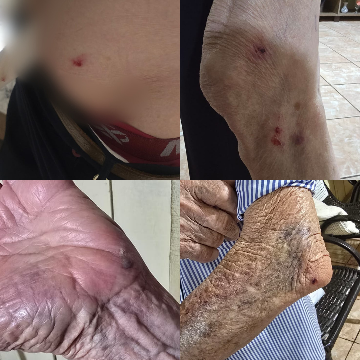 Cachorro derruba e morde idoso de 87 anos a caminho do mercado na Vila Nasser