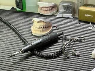 Lu&iacute;s faz grillz famosos entre rappers e pedidos at&eacute; por crian&ccedil;as