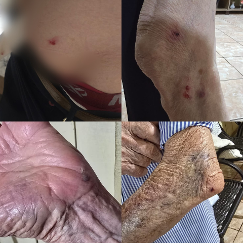 Cachorro derruba e morde idoso de 87 anos a caminho do mercado na Vila Nasser