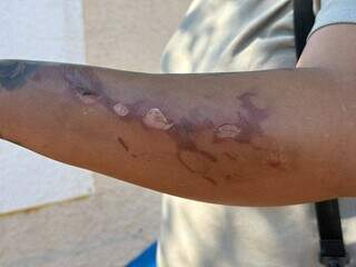 &ldquo;Vi meus filhos em chamas&rdquo;, diz m&atilde;e ap&oacute;s explos&atilde;o que matou crian&ccedil;a de 3 anos 