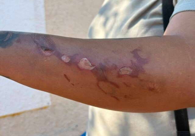&ldquo;Vi meus filhos em chamas&rdquo;, diz m&atilde;e ap&oacute;s explos&atilde;o que matou crian&ccedil;a de 3 anos 