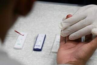 Medicamentos ampliam a prote&ccedil;&atilde;o contra o HIV, mas outras ISTs avan&ccedil;am na Capital