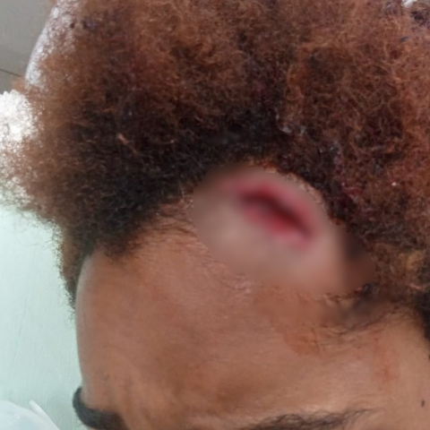 Homem agride ex-companheira e amigos com bengala de moto e foge no Santa Luzia