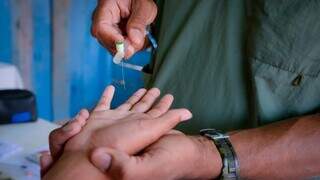 Teste molecular para hanseníase terá uso ampliado no SUS Teste molecular para hanseníase terá uso ampliado no SUS