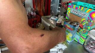 "Não era minha hora", diz comerciante baleado de raspão em atentado com 16 tiros "Não era minha hora", diz comerciante baleado de raspão em atentado com 16 tiros