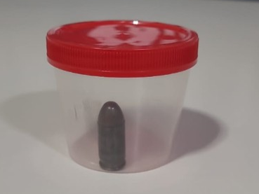 Muni&ccedil;&atilde;o intacta &eacute; retirada do intestino de homem durante cirurgia
