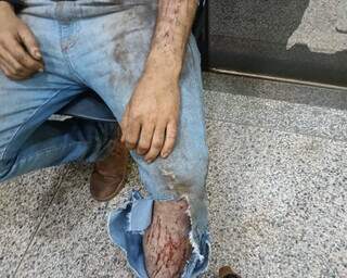 Jovem relata ataque de on&ccedil;a enquanto trabalhava em colheitadeira em &aacute;rea rural