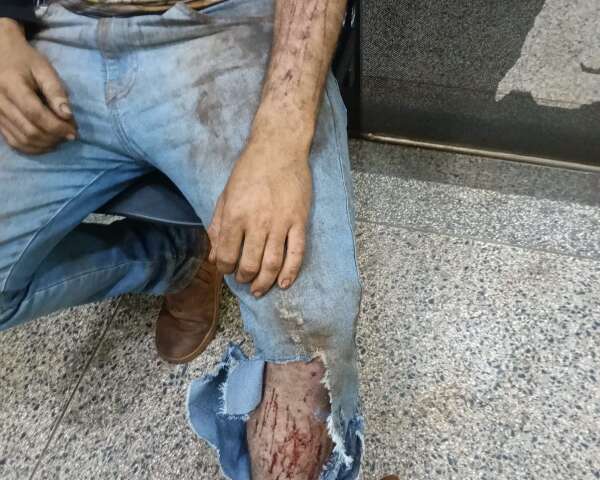 Jovem relata ataque de on&ccedil;a enquanto trabalhava em colheitadeira em &aacute;rea rural
