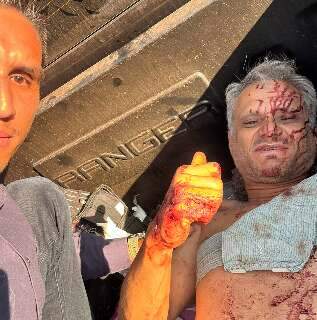 &ldquo;Nunca vi nada igual&rdquo;, diz policial que encarou chamas para salvar motorista 