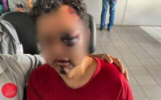 Trio usa &ldquo;boa-noite, Cinderela&rdquo;, espanca homem e rouba carro 