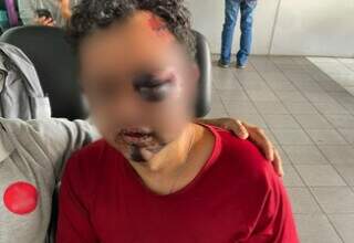 Carro roubado de homem dopado e espancado &eacute; recuperado a caminho do Paraguai