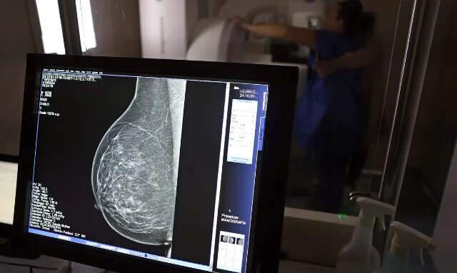 Health plans in Brazil must cover digital mammograms for any patient with a medical indication