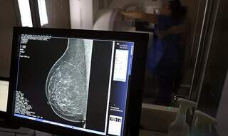 Planos de sa&uacute;de ter&atilde;o de cobrir mamografia digital em qualquer idade