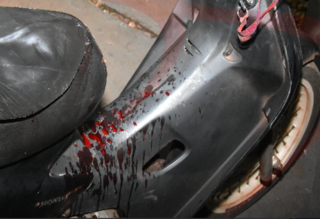 Baleado no pesco&ccedil;o, motociclista pede ajuda em hospital e &eacute; intubado