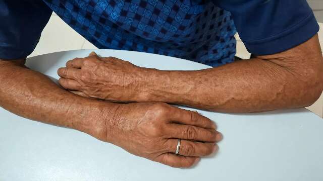 CAPS, grupos e novos v&iacute;nculos ajudam Ant&ocirc;nio a reconstruir vida sem &aacute;lcool