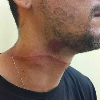 Motociclista fica ferido após ser atingido por fio solto de telefonia Motociclista fica ferido após ser atingido por fio solto de telefonia