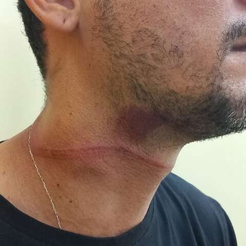 Motociclista fica ferido ap&oacute;s ser atingido por fio solto de telefonia