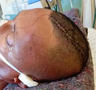 Ap&oacute;s 19 dias na UTI, homem encontrado espancado em avenida morre 