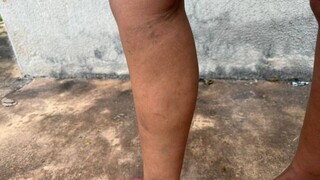Após estupro e ameaças de morte, mulher busca socorro na Deam Após estupro e ameaças de morte, mulher busca socorro na Deam