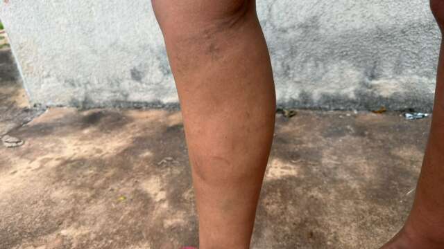 Ap&oacute;s estupro e amea&ccedil;as de morte, mulher busca socorro na Deam