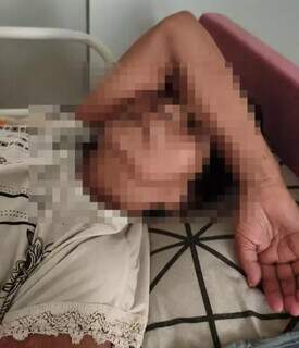 Com sangramento intenso, idosa espera há 6 dias por endoscopia na Santa Casa Com sangramento intenso, idosa espera há 6 dias por endoscopia na Santa Casa