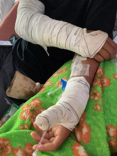 Vítimas de acidente relatam espera de quase 2 semanas por cirurgia na Santa Casa Vítimas de acidente relatam espera de quase 2 semanas por cirurgia na Santa Casa
