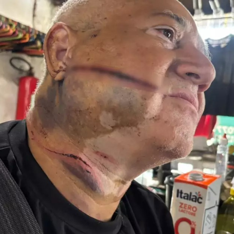 &ldquo;Me livrei da morte 2 vezes&rdquo;, diz comerciante ferido em tentativa de roubo