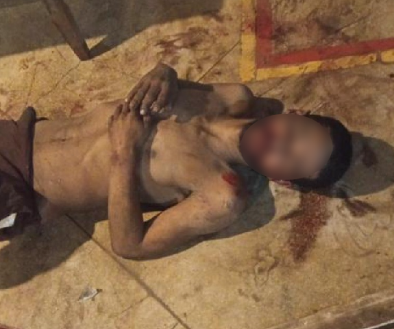 Ladr&atilde;o atinge idoso com golpes de fac&atilde;o durante tentativa de furto em com&eacute;rcio