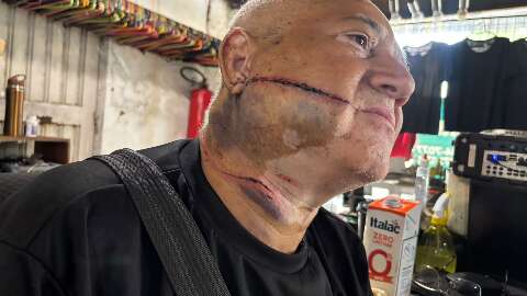 &ldquo;Me livrei da morte 2 vezes&rdquo;, diz comerciante ferido em tentativa de roubo