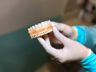 Lentes e clareamento são opções para renovar o sorriso na Odonto Go Lentes e clareamento são opções para renovar o sorriso na Odonto Go