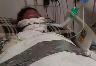 Justi&ccedil;a manda INSS pagar pens&atilde;o a filhos de mulher queimada pelo marido