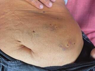 Homem que cortou vagina da ex-namorada vai a júri popular em novembro Homem que cortou vagina da ex-namorada vai a júri popular em novembro