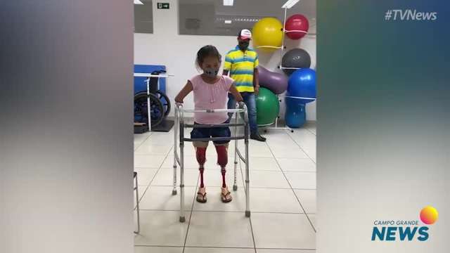 Após ganhar prótese, menina vira Mulher-Maravilha