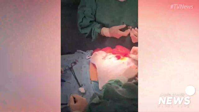 Cirurgião tira 78 cápsulas de droga de mula do tráfico