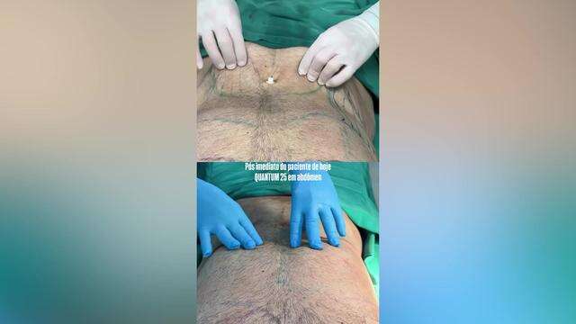 Entenda a tecnologia