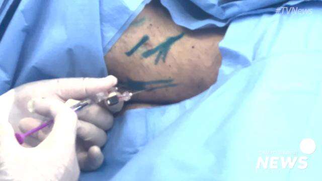 Cirurgia com Polilaminina